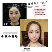 北京脂肪填充失败修复专家 