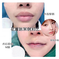 七星艺容术整形