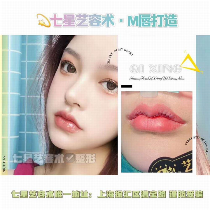 上海七星艺容术整形