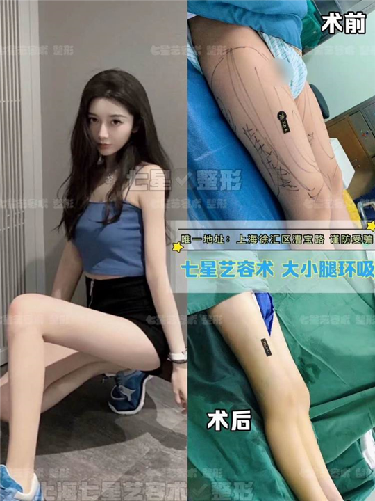 上海人气网红整形基地