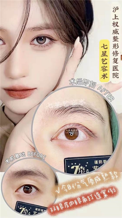 上海七星艺容术整形