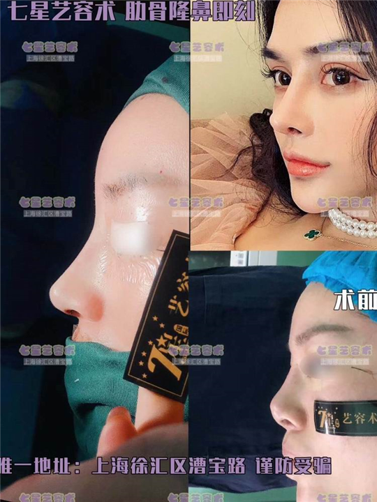 上海网红整形