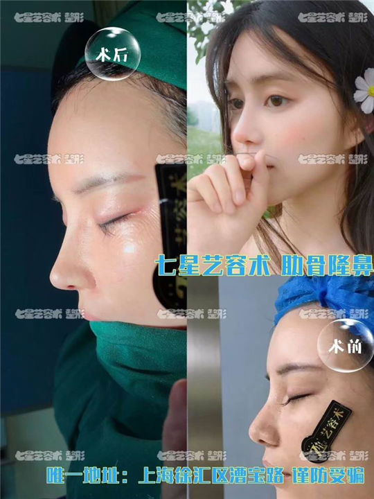 上海网红整形