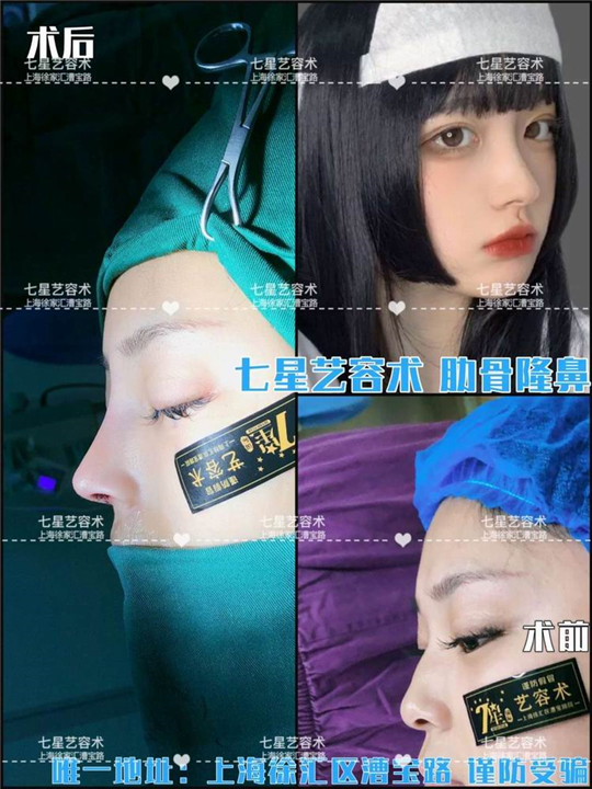 上海网红整形