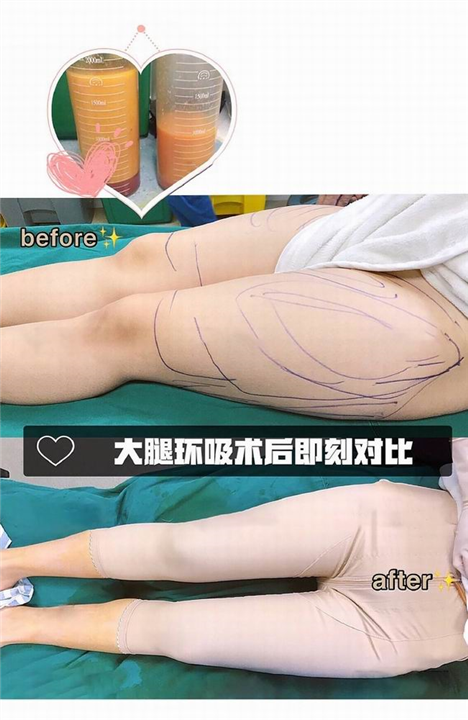 上海网红整形