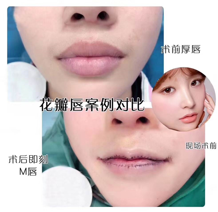七星艺容术整形