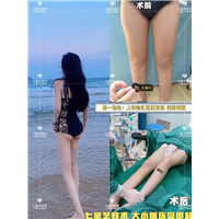 上海网红整形