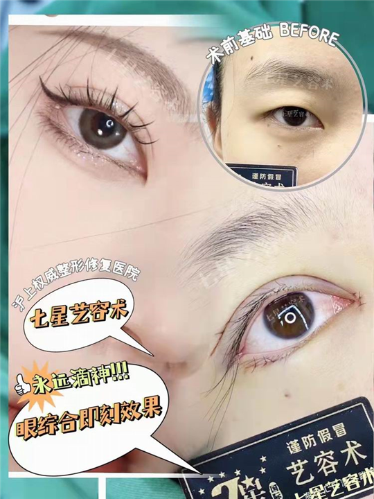 七星艺容术整形