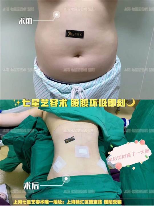 上海人气网红整形基地