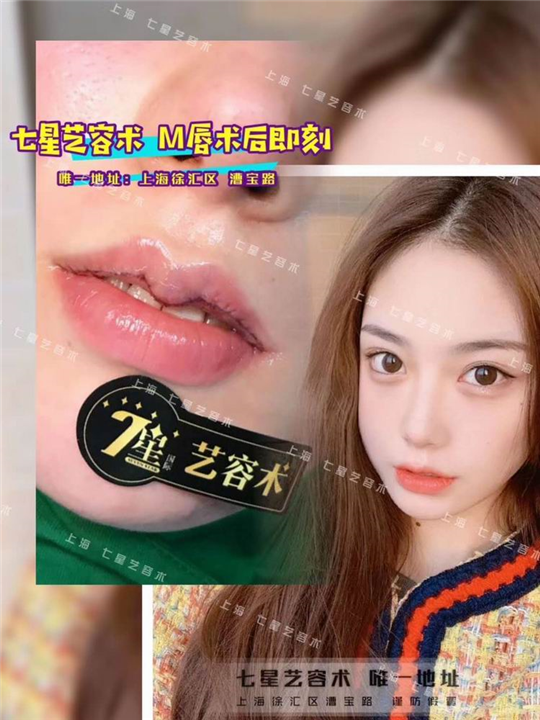 上海七星艺容术整形