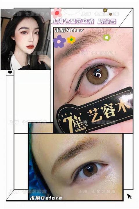 七星艺容术整形