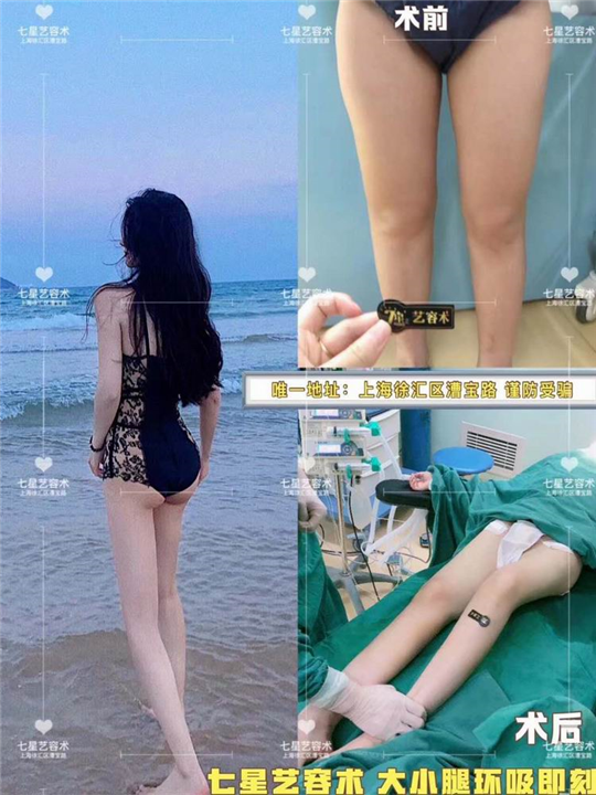 上海网红整形