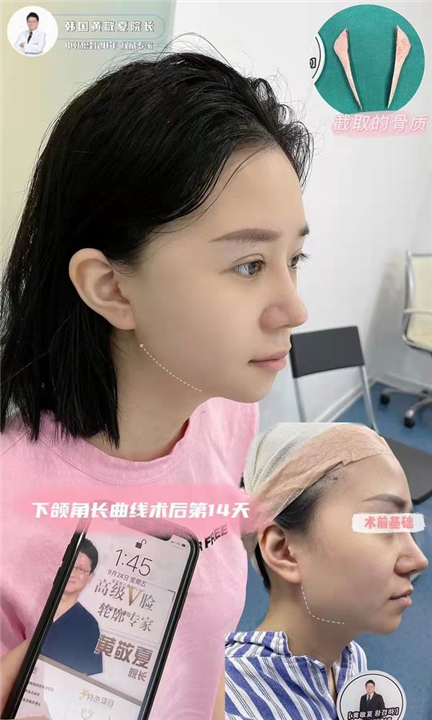 七星艺容术整形地址