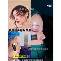 上海网红整形