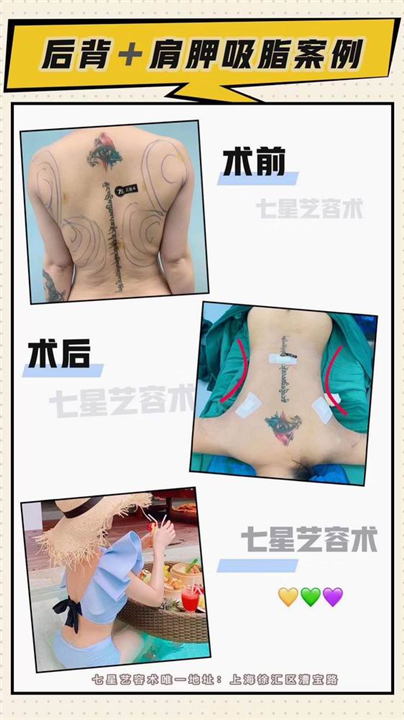 上海人气网红整形基地