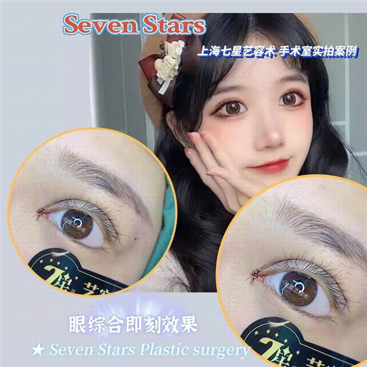 七星艺容术整形