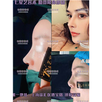 上海网红整形
