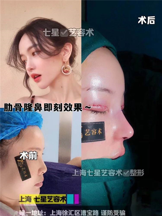 上海网红整形