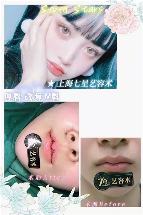 上海七星艺容术整形