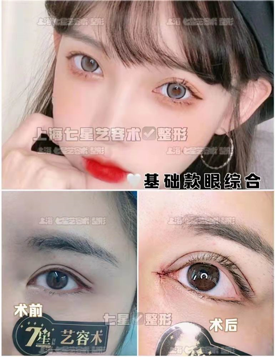 七星艺容术整形