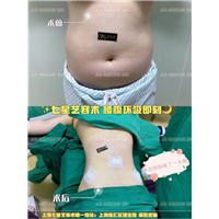 上海人气网红整形基地