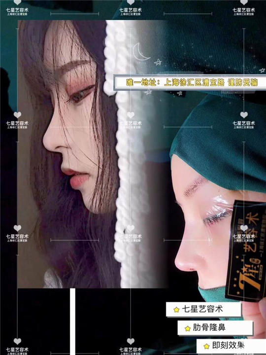 上海网红整形