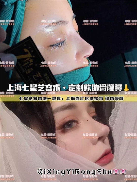 上海网红整形
