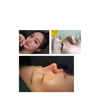 上海做鼻子哪家好