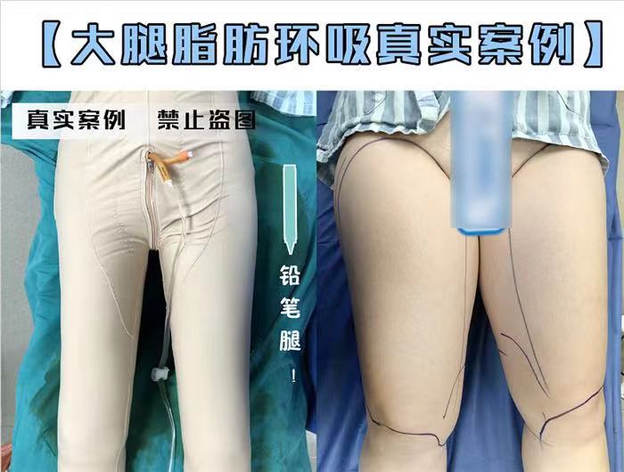 上海女神时代整形