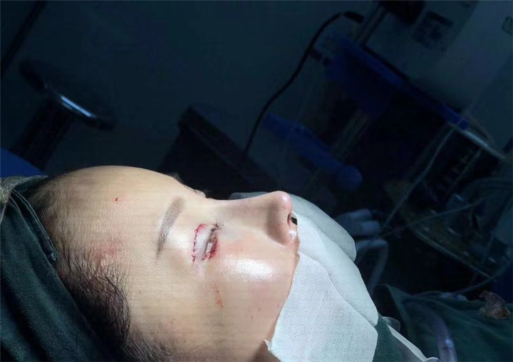 上海鼻综合整形医生