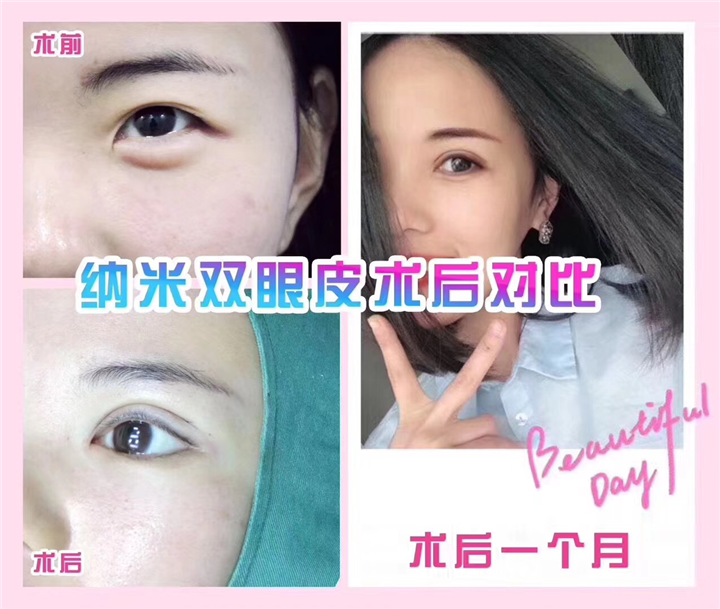 上海眼综合整形