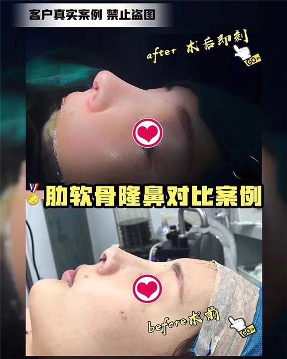 上海鼻综合整形医生