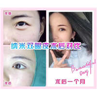 上海眼综合整形