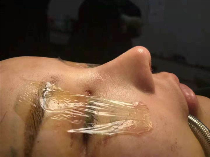 上海鼻综合整形医生