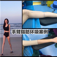 上海抽脂整形