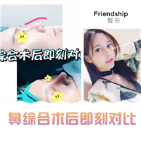 上海鼻整形
