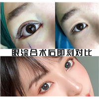 上海综合整形多少钱