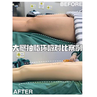 上海女神时代整形