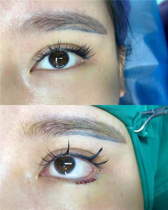 上海眼综合整形
