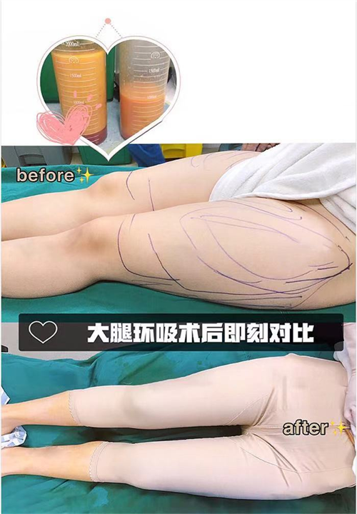 上海女神时代整形