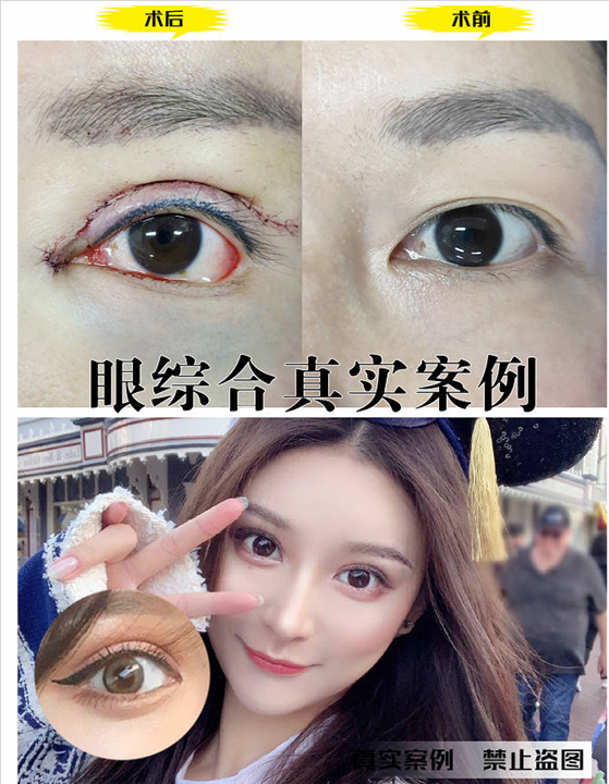 上海眼综合多少钱