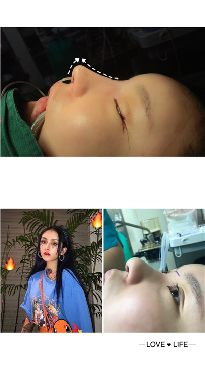 上海鼻综合有名的医生