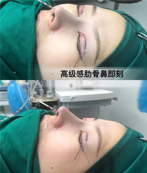 上海鼻综合整形医生