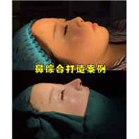 上海女神时代整形王武松鼻整形