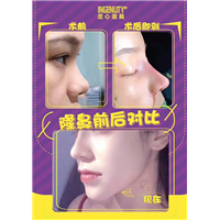 女神时代鼻整形王武松院长