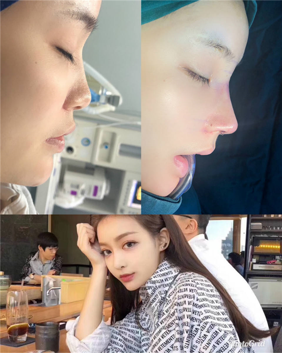 上海隆鼻整形哪里好