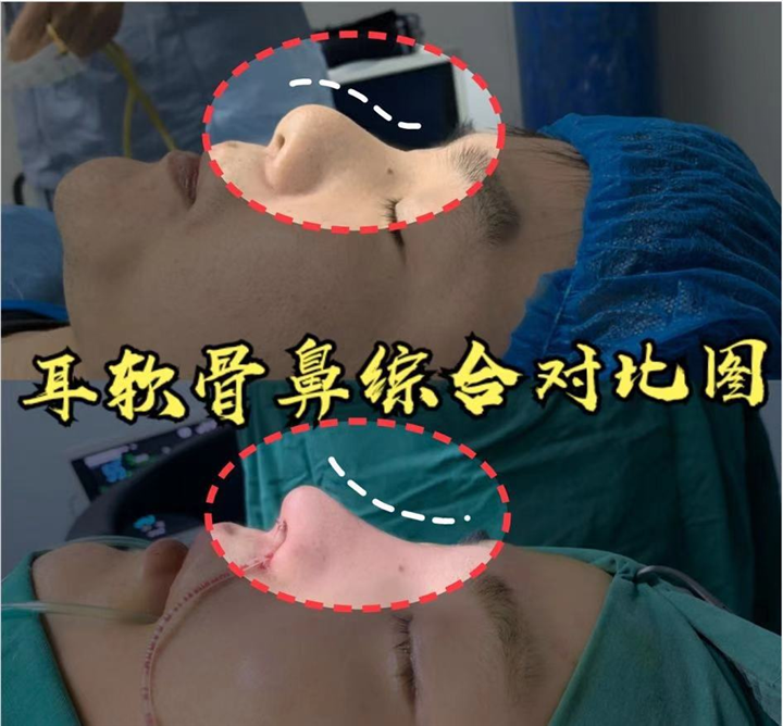 上海鼻综合整形医生