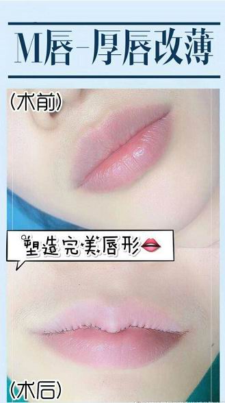 天丽卡婕宁整形 