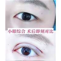 重庆眼综合修复