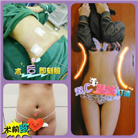重庆整形医院推荐 